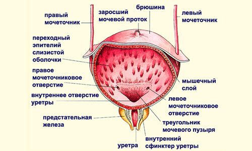 Если вставили катетером фолея в мочевой пузырь