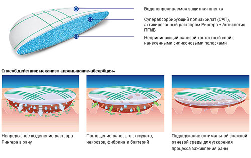 рингера