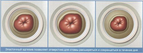 plastichnaj4