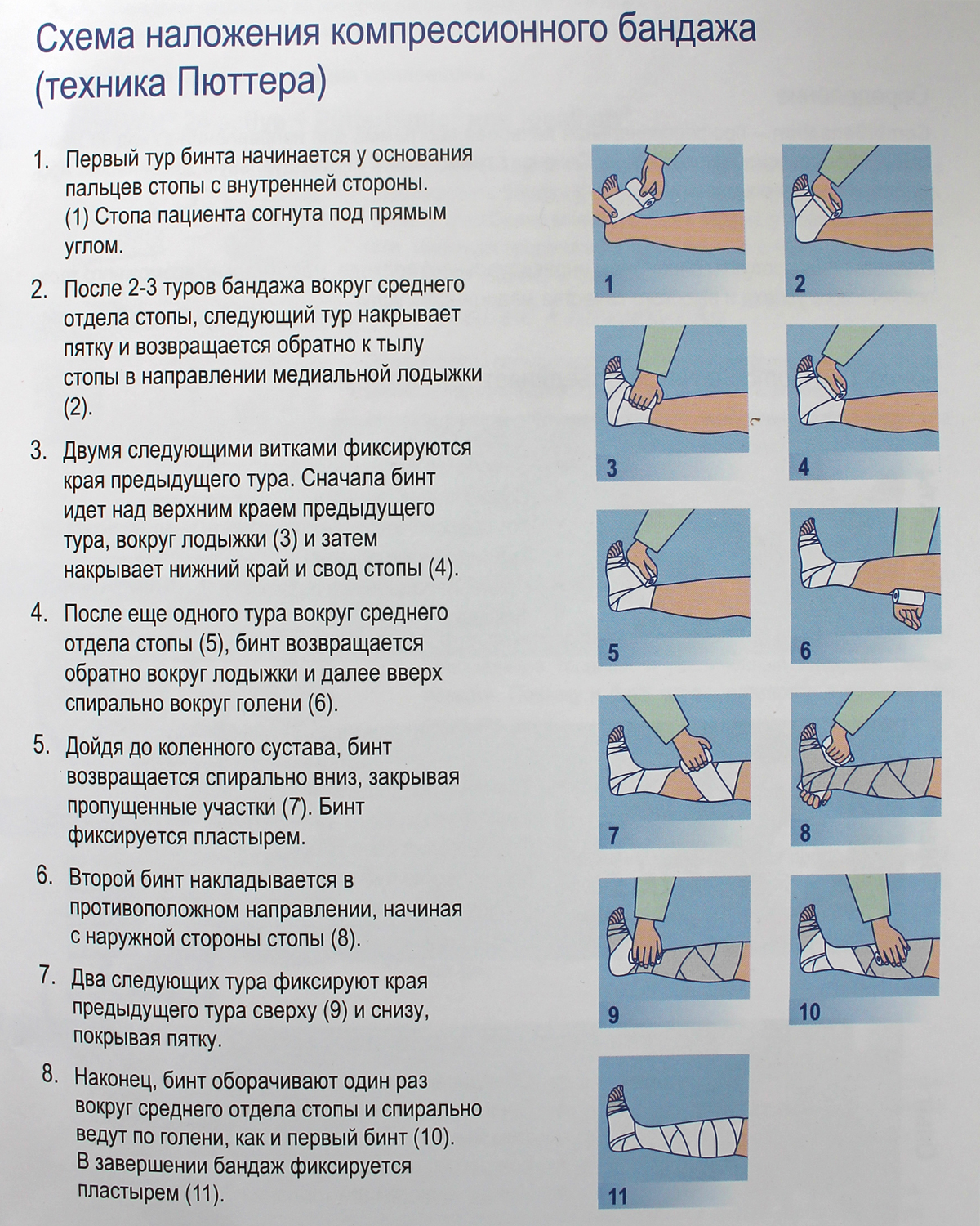 Эластичное бинтование конечности. Компрессию нижних конечностей эластичным бинтом алгоритм. Техника наложения эластичного бинта на нижнюю конечность. Техника наложения компрессионной повязки. Алгоритм бинтования ног эластическим бинтом.