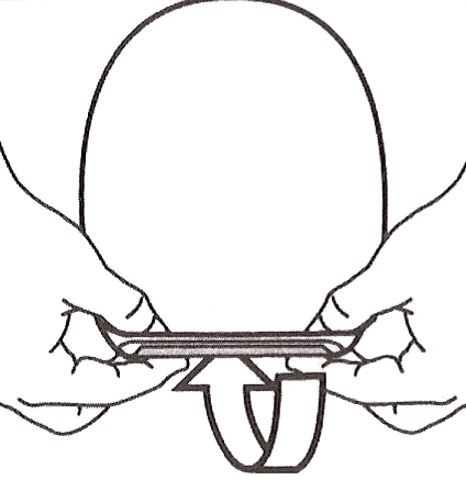 https://www.mystoma.ru/published/publicdata/WWWMYSTOMAORGWEBASYST/attachments/SC/images/16_111.jpg