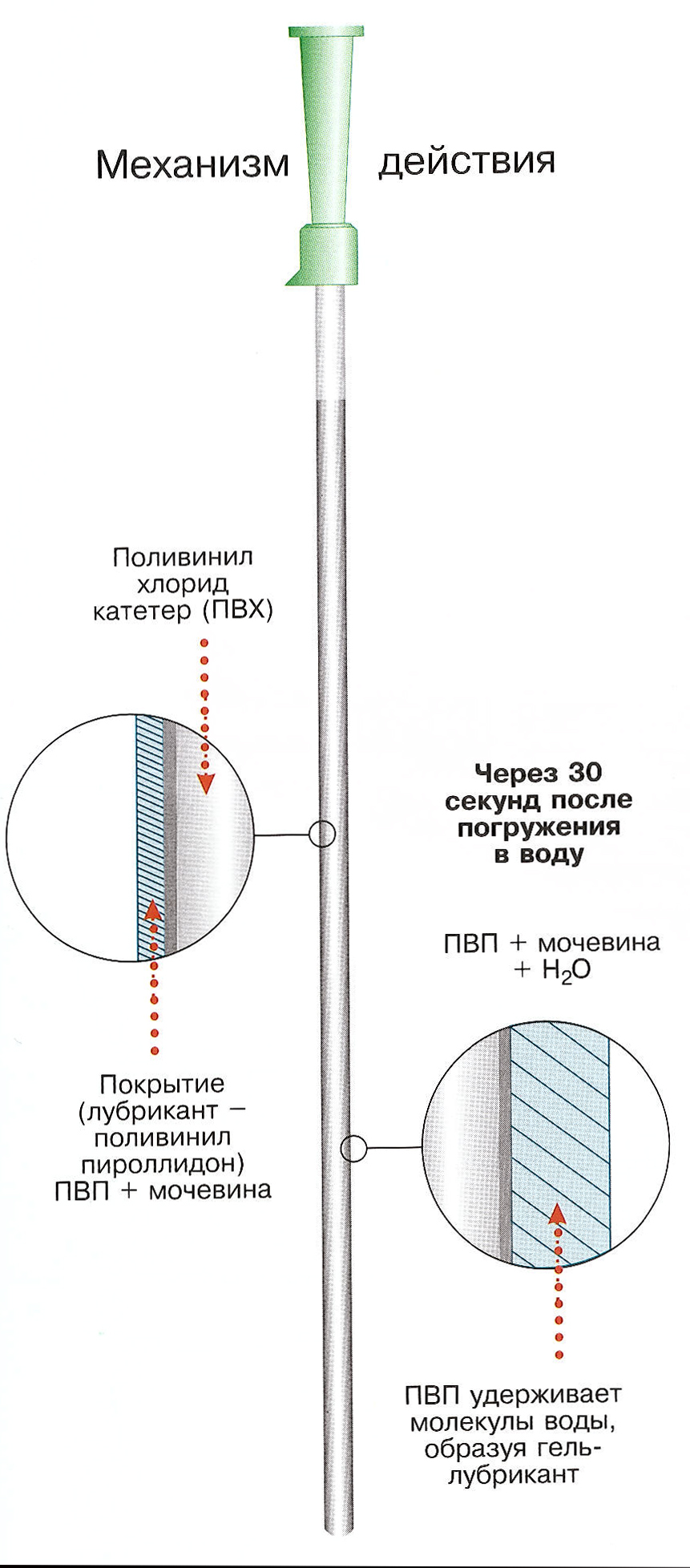 https://www.mystoma.ru/published/publicdata/WWWMYSTOMAORGWEBASYST/attachments/SC/images/EasiCath.jpg