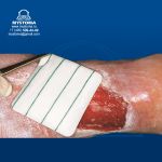 609612# HydroClean plus - Повязки актив. раствором Рингера с ПГМБ: 10х10 см, 10 шт.  